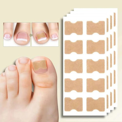 Ingrown Nail Correction Tool with Instant Repair Treatment